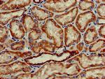 HAO2 Antibody in Immunohistochemistry (Paraffin) (IHC (P))