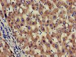 HAO2 Antibody in Immunohistochemistry (Paraffin) (IHC (P))