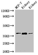 HAO2 Antibody in Western Blot (WB)