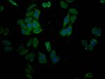 SLC28A3 Antibody in Immunocytochemistry (ICC/IF)