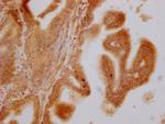 SLC28A3 Antibody in Immunohistochemistry (Paraffin) (IHC (P))