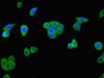 ALKBH4 Antibody in Immunocytochemistry (ICC/IF)