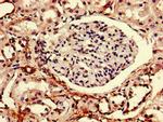 Rtp3 Antibody in Immunohistochemistry (Paraffin) (IHC (P))