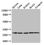 Rtp3 Antibody in Western Blot (WB)