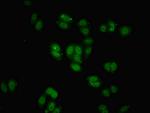 BRD9 Antibody in Immunocytochemistry (ICC/IF)