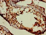 SLC6A13 Antibody in Immunohistochemistry (Paraffin) (IHC (P))