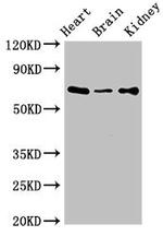 SLC6A13 Antibody in Western Blot (WB)