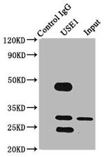 USE1 Antibody in Immunoprecipitation (IP)