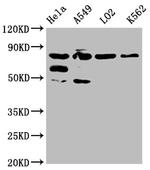 MTRR Antibody in Western Blot (WB)