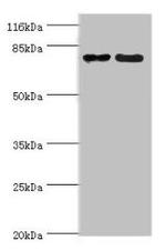 MTRR Antibody in Western Blot (WB)