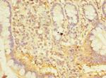 SNX6 Antibody in Immunohistochemistry (Paraffin) (IHC (P))