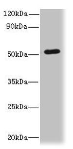 SNX6 Antibody in Western Blot (WB)