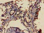 SHOC2 Antibody in Immunohistochemistry (Paraffin) (IHC (P))