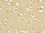 FBXO4 Antibody in Immunohistochemistry (Paraffin) (IHC (P))