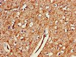 GAB2 Antibody in Immunohistochemistry (Paraffin) (IHC (P))