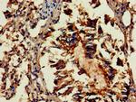 GAB2 Antibody in Immunohistochemistry (Paraffin) (IHC (P))