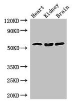 SLC7A7 Antibody in Western Blot (WB)