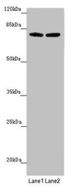 FBXL5 Antibody in Western Blot (WB)