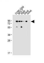 MDM2 Antibody in Western Blot (WB)