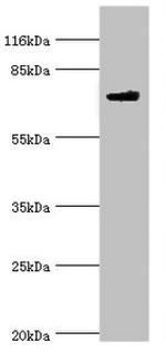 MTMR7 Antibody in Western Blot (WB)