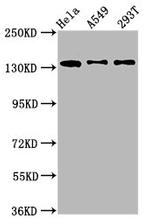 MAN2B2 Antibody in Western Blot (WB)