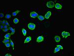 CEP83 Antibody in Immunocytochemistry (ICC/IF)