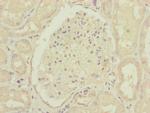 CEP83 Antibody in Immunohistochemistry (Paraffin) (IHC (P))