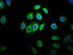 C11orf9 Antibody in Immunocytochemistry (ICC/IF)