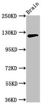 C11orf9 Antibody in Western Blot (WB)