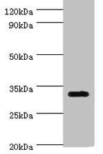 ORNT1 Antibody in Western Blot (WB)