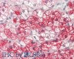 Kinesin 5B Antibody in Immunohistochemistry (Paraffin) (IHC (P))