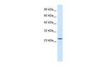 RNF3 Antibody in Western Blot (WB)