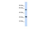 RNF3 Antibody in Western Blot (WB)