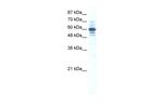 ZNF276 Antibody in Western Blot (WB)