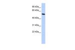 ZNF572 Antibody in Western Blot (WB)