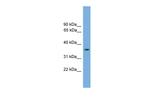 FOXF1 Antibody in Western Blot (WB)