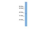 SIX3 Antibody in Western Blot (WB)