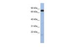 SIM1 Antibody in Western Blot (WB)