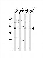 SUV39H2 Antibody in Western Blot (WB)