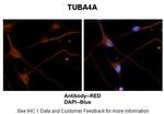 TUBA4A Antibody in Immunohistochemistry (IHC)