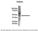 TUBA4A Antibody in Immunoprecipitation (IP)