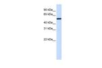 TUBA4A Antibody in Western Blot (WB)