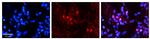 SNRNP70 Antibody in Immunohistochemistry (Paraffin) (IHC (P))