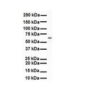 SNRNP70 Antibody in Western Blot (WB)