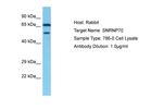 SNRNP70 Antibody in Western Blot (WB)