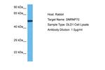 SNRNP70 Antibody in Western Blot (WB)