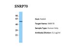 SNRNP70 Antibody in Western Blot (WB)