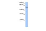 YARS Antibody in Western Blot (WB)