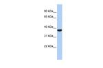 RRP4 Antibody in Western Blot (WB)