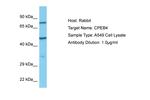 CPEB4 Antibody in Western Blot (WB)